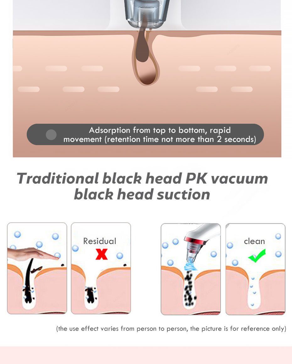 Comedondrukker Gezicht Deep Neus Cleaner T Zone Porie Acne Puistje Removal Vacuüm Zuig Facial Diamant Schoonheid Schone Huid Tool