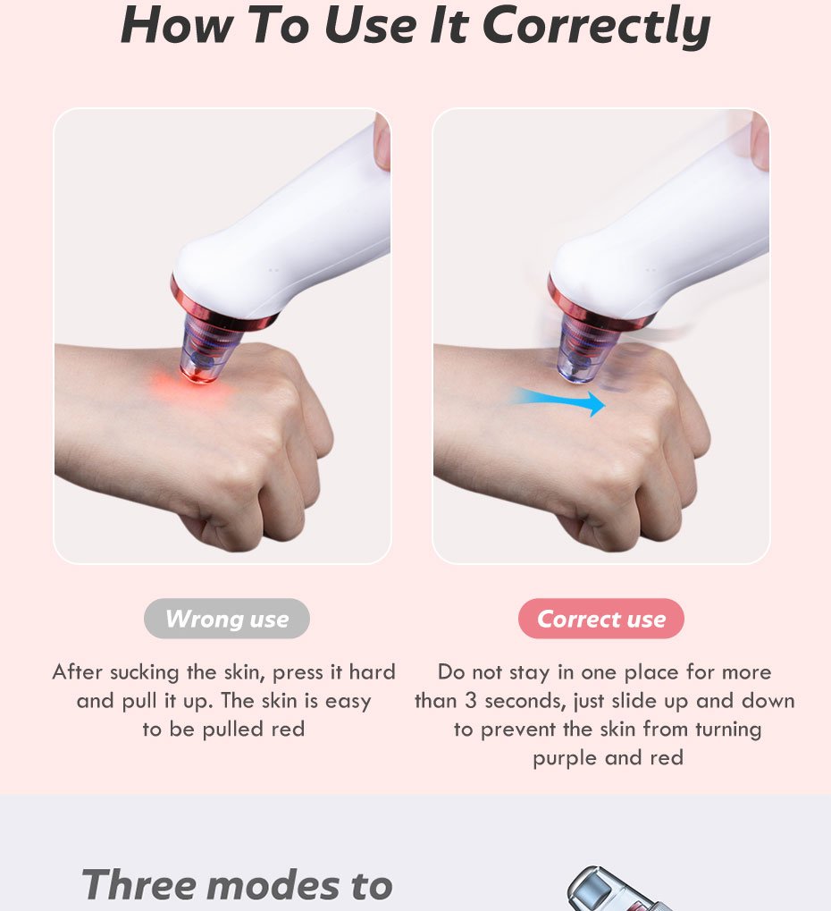 Comedondrukker Gezicht Deep Neus Cleaner T Zone Porie Acne Puistje Removal Vacuüm Zuig Facial Diamant Schoonheid Schone Huid Tool