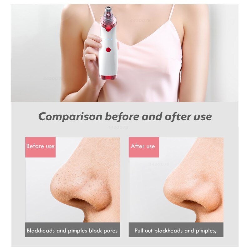 Comedondrukker Gezicht Deep Neus Cleaner T Zone Porie Acne Puistje Removal Vacuüm Zuig Facial Diamant Schoonheid Schone Huid Tool