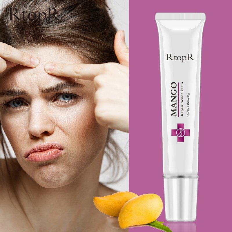 Acne Behandeling Gezicht Crème Mee-eter Reparatie Gel Olie Controle Krimpen Poriën Litteken Whitening Moisturizer Huidverzorging Koreaanse Cosmetica