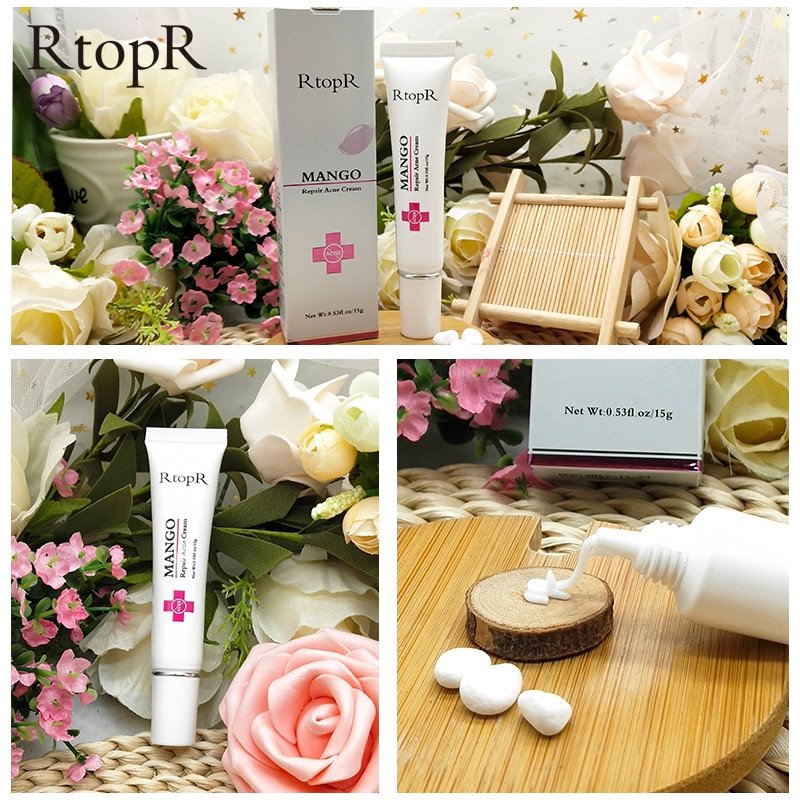 Acne Behandeling Gezicht Crème Mee-eter Reparatie Gel Olie Controle Krimpen Poriën Litteken Whitening Moisturizer Huidverzorging Koreaanse Cosmetica