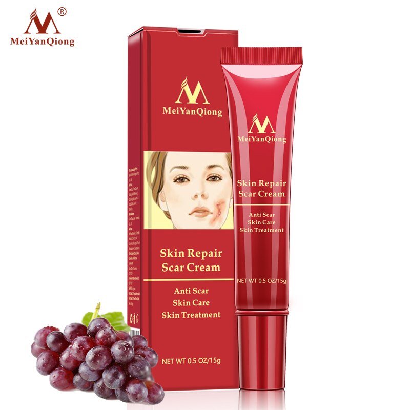 Acne Litteken Verwijdering Gezicht Crème Acne Vlekken Acne Pigmentatie Corrector Whitening Cream Anti Litteken Striae Reparatie Huidverzorging