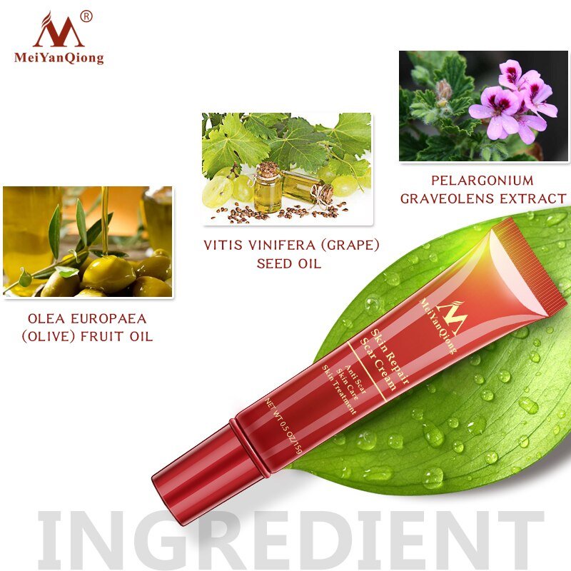 Acne Litteken Verwijdering Gezicht Crème Acne Vlekken Acne Pigmentatie Corrector Whitening Cream Anti Litteken Striae Reparatie Huidverzorging