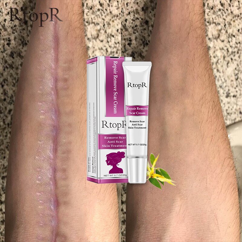 Rtopr Acne Litteken Striae Remover Crème Huid Reparatie Gezichtscrème Acne Vlekken Acne Behandeling Mee-eter Whitening Cream Huidverzorging