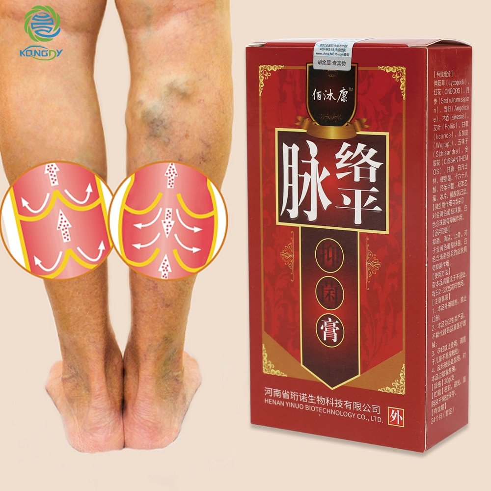 KONGDY Varicose Veins Treatment Cream Varicosity Angiitis Remedy Ointment Relief Veins Pain Phlebitis legs Varicose Veins Cream KONGDY Varicose Veins Treatment Cream Varicosity Angiitis Remedy Ointment Relief Veins Pain Phlebitis legs Varicose Veins Cream