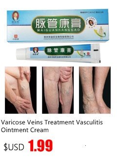 KONGDY Varicose Veins Treatment Cream Varicosity Angiitis Remedy Ointment Relief Veins Pain Phlebitis legs Varicose Veins Cream