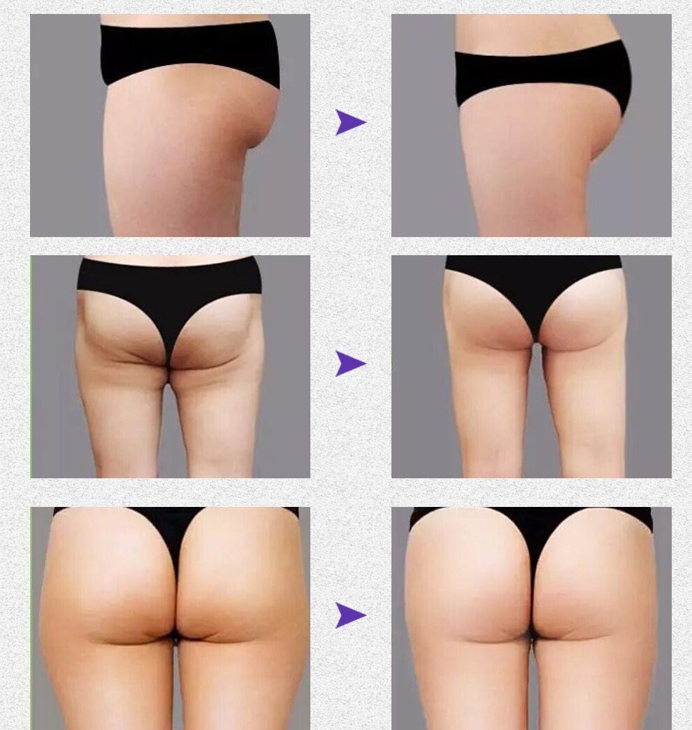 Hip Lift Up Buttock Massage Essential Oil Butt Enlargement Cellulite Cream Firming and Lifting for Women Big Butt 10ML TSLM2