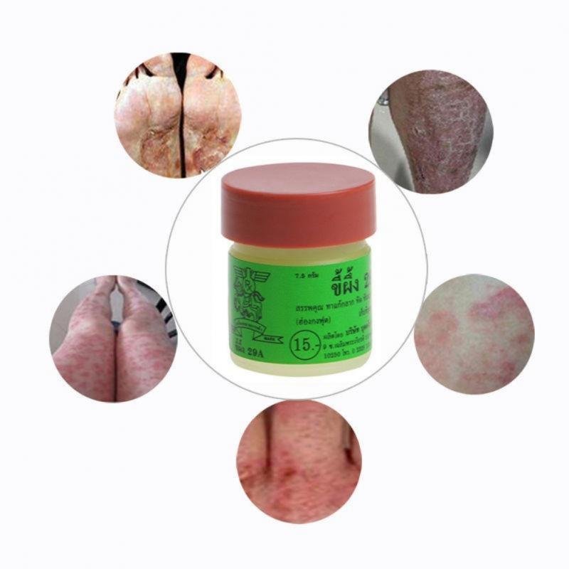 1Pcs Natuurlijke Crème Werkt Echt Goed Voor Psoriasi Eczma 29A Originele Psoriasis Dermatitis Eczeem Jeuk Huid Problemen Crème