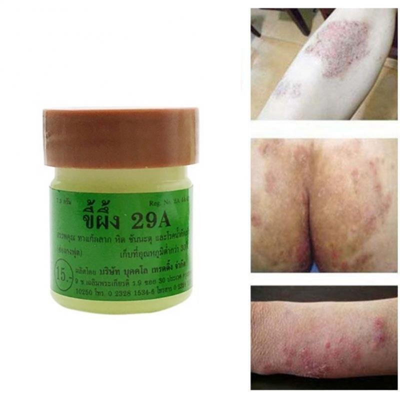1Pcs Natuurlijke Crème Werkt Echt Goed Voor Psoriasi Eczma 29A Originele Psoriasis Dermatitis Eczeem Jeuk Huid Problemen Crème