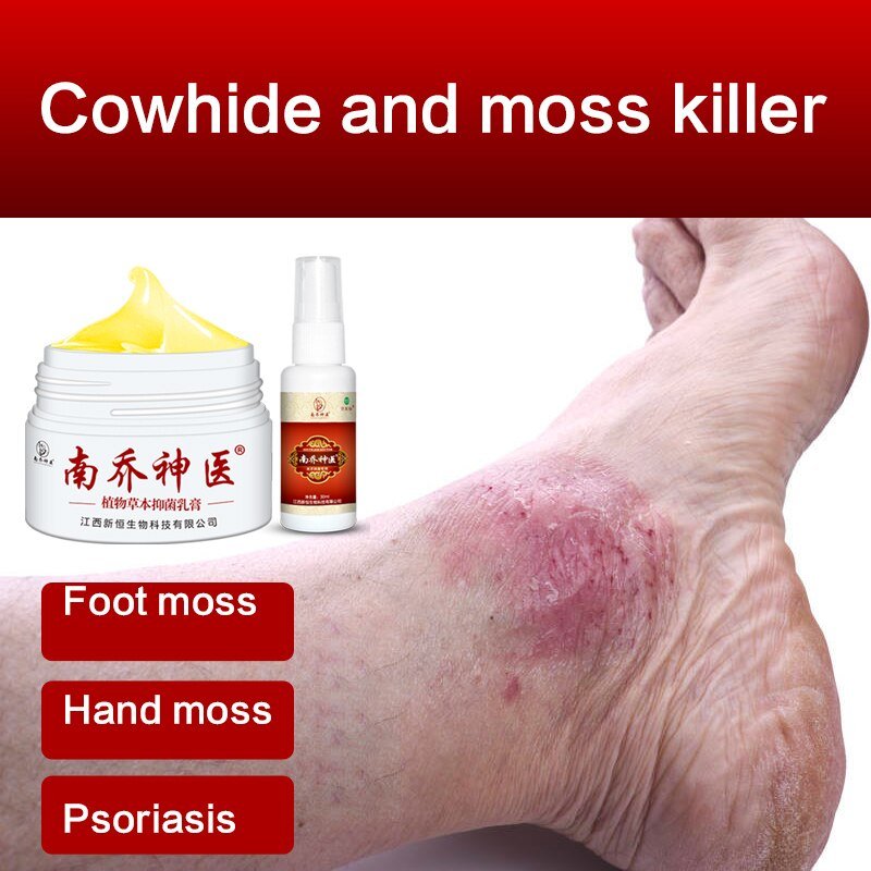 30G Dermatitis Crème Huid Psoriasis Crème Dermatitis Eczematoid Eczeem Zalf Behandeling Psoriasis Crème Gezondheidszorg 30G Dermatitis Crème Huid Psoriasis Crème Dermatitis Eczematoid Eczeem Zalf Behandeling Psoriasis Crème Gezondheidszorg