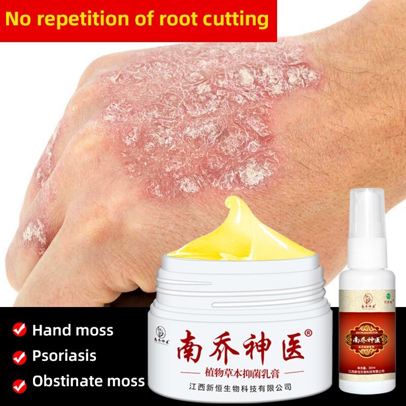 30G Dermatitis Crème Huid Psoriasis Crème Dermatitis Eczematoid Eczeem Zalf Behandeling Psoriasis Crème Gezondheidszorg 30G Dermatitis Crème Huid Psoriasis Crème Dermatitis Eczematoid Eczeem Zalf Behandeling Psoriasis Crème Gezondheidszorg