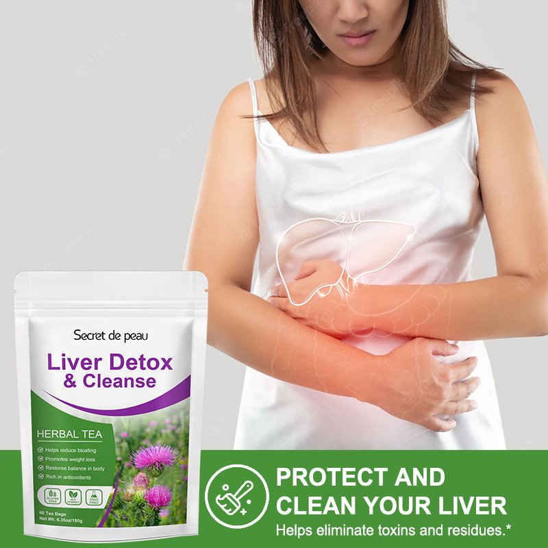 Sdp Dieet Natuurlijke L-Iver Detox Thee Opruimen Van Warmte Ontgiftende Ondersteunt Lever Metabolisme Organic Herbal L-Iver gezondheid Voedsel Thee