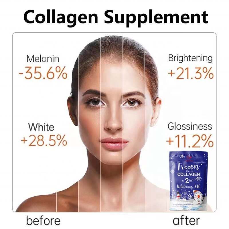 Winstown Bevroren Collageen Detox Huid Whitening Capsules Bevroren Collageen 2 In 1 Whitening Supplementen Voor Donkere Huid Detox Capsule Winstown Bevroren Collageen Detox Huid Whitening Capsules Bevroren Collageen 2 In 1 Whitening Supplementen Voor Donkere Huid Detox Capsule