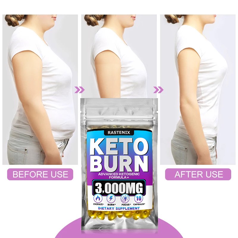 Beste gewichtsverlies vetverbrandende supplementen snel gewichtsverlies vetverbranding metabolisme detox beauty veganistische keto voor gewichtsbeheersing