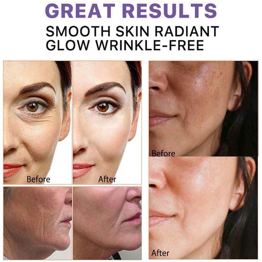 Retinol Verwijderen Rimpel Gezichtscrème Anti-Aging Verstevigende Lifting Vervagen Fijne Lijnen Verbeteren Wallen Hydraterende Fleuren Huidverzorging