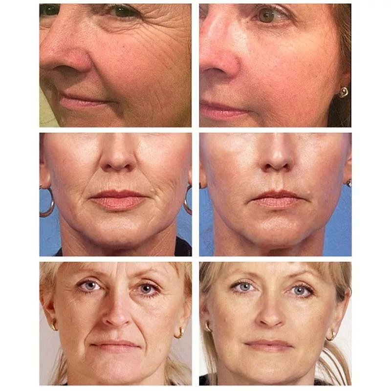 Retinol Verwijderen Rimpel Gezichtscrème Anti-Aging Verstevigende Lifting Vervagen Fijne Lijnen Verbeteren Wallen Hydraterende Fleuren Huidverzorging