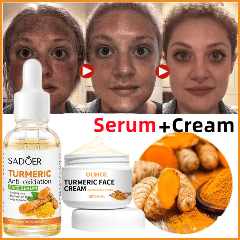 Kurkuma Whitening Sproet Serum Vervagen Donkere Spot Acne Litteken Heldere Gezicht Huid Corrector Curcumine Lichter Melanine Verbeteren Ruwheid Kurkuma Whitening Sproet Serum Vervagen Donkere Spot Acne Litteken Heldere Gezicht Huid Corrector Curcumine Lichter Melanine Verbeteren Ruwheid