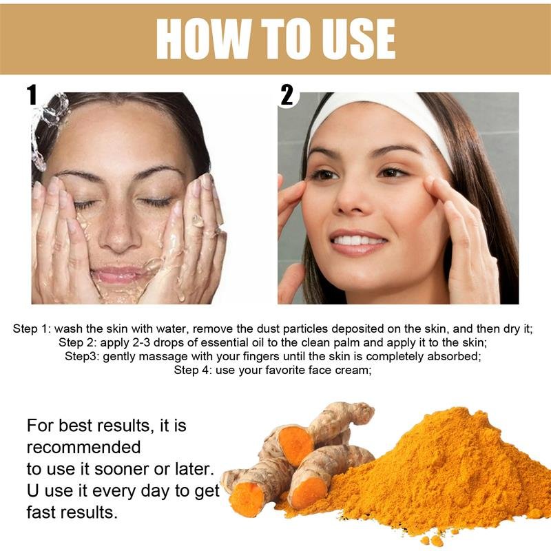Kurkuma Sproet Whitening Serum Curcumine Olie Fleuren Vervagen Donkere Vlek Verwijdering Pigment Melanine Corrigeren Schoonheid Gezicht Huidverzorging