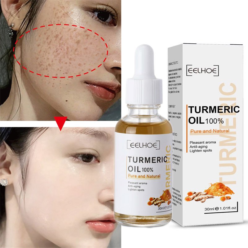 Kurkuma Sproet Whitening Serum Curcumine Olie Fleuren Vervagen Donkere Vlek Verwijdering Pigment Melanine Corrigeren Schoonheid Gezicht Huidverzorging