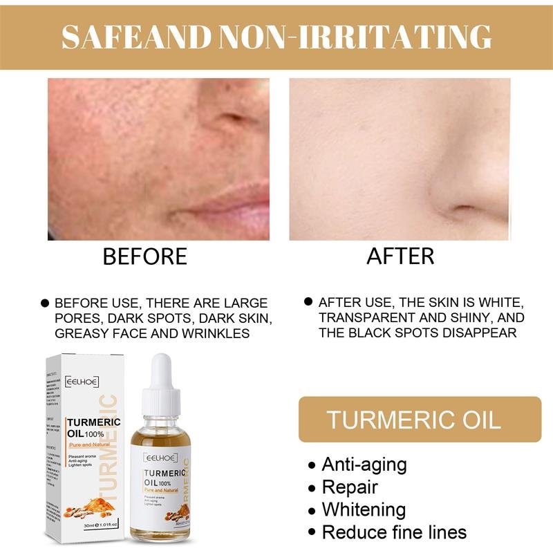 Kurkuma sproet whitening serum curcumine olie fleuren fade dark spot verwijdering pigment melanine corrigeert schoonheid gezicht huidverzorging