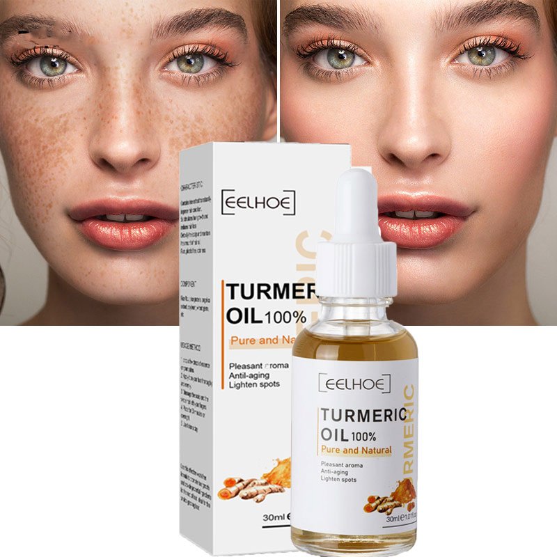 Kurkuma sproet whitening serum curcumine olie fleuren fade dark spot verwijdering pigment melanine corrigeert schoonheid gezicht huidverzorging