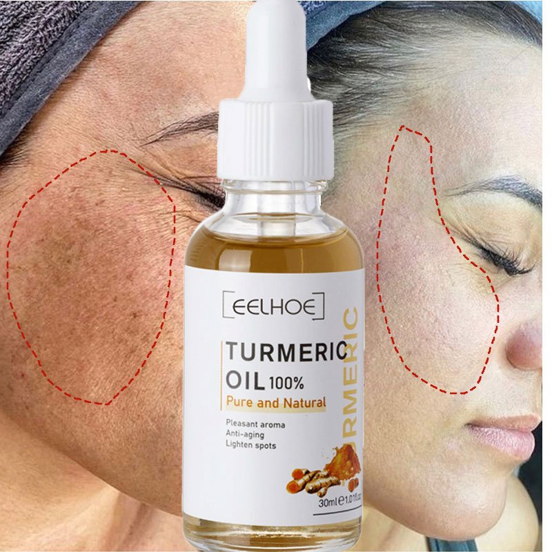 Kurkuma sproet whitening serum curcumine olie fleuren fade dark spot verwijdering pigment melanine corrigeert schoonheid gezicht huidverzorging