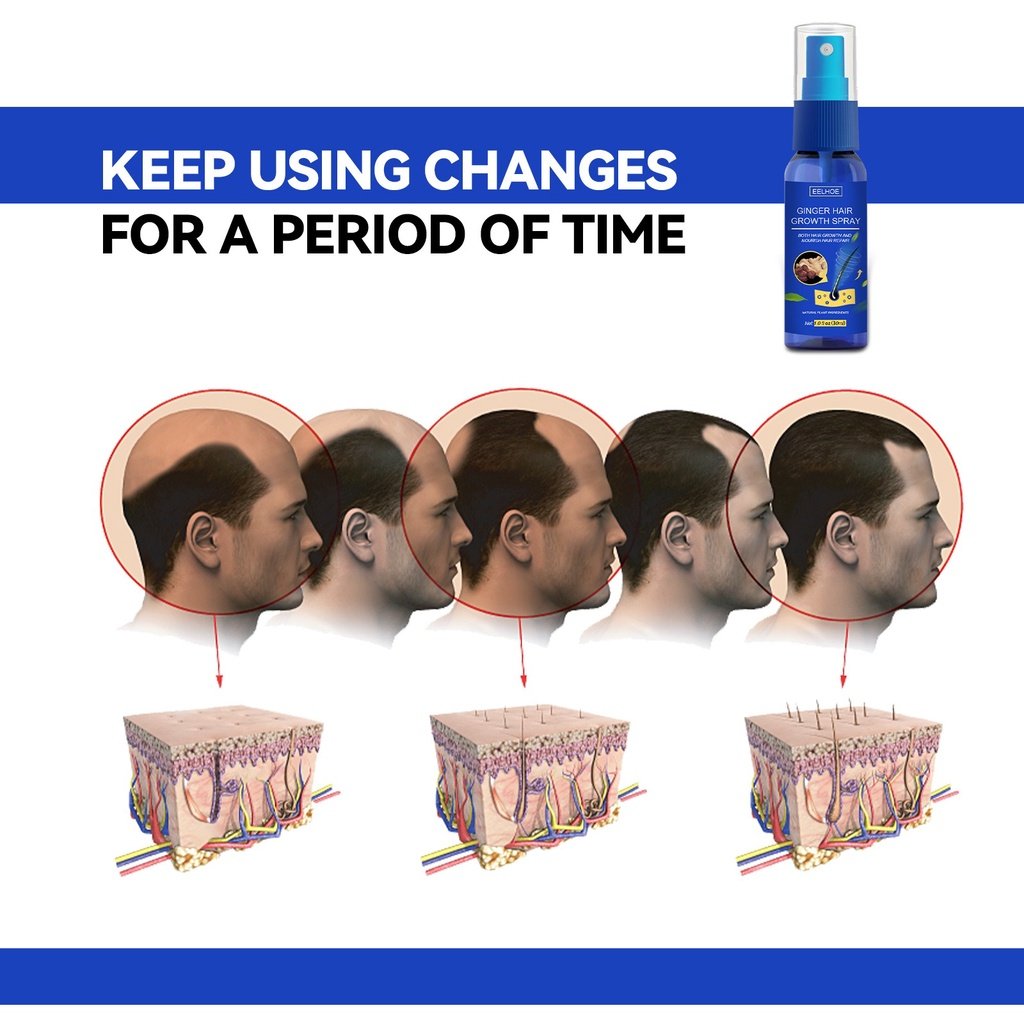 2022 Gember Haar Teler Spray Anti Haar Val Haaruitval Behandeling Haargroei Essentie Olie Voor Mannen Vrouwen